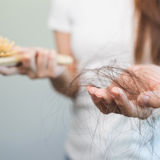 Olika orsaker till håravfall